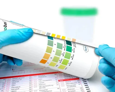 Produktbild von Roche Combur 3 Test Urinteststreifen 50 Stück (11896814191)