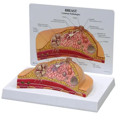 Brustmodell Querschnitt, anatomisch, mit Pathologien, 1 St.