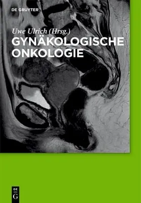 Immagine prodotto di Gynäkologische Onkologie