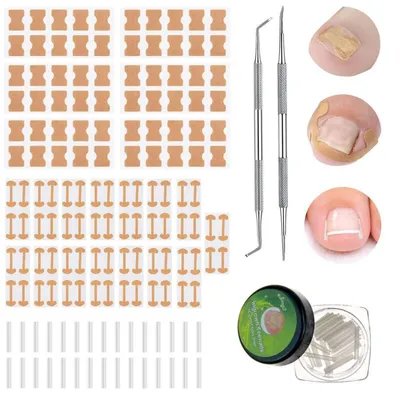 Produktbild von 152-teiliges Zehennagelkorrektur-Set mit Feile und Heber