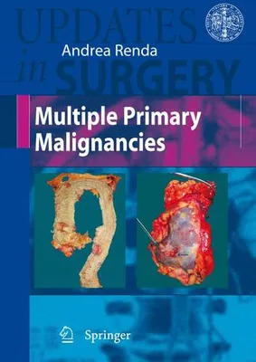 Obrázok produktu pre Multiple Primary Malignancies