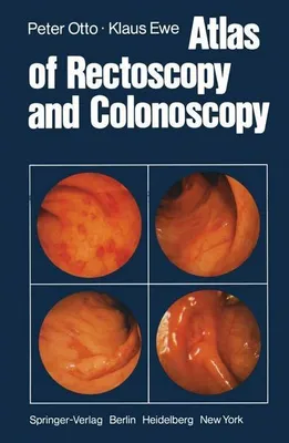 Immagine prodotto di Atlas of Rectoscopy and Coloscopy