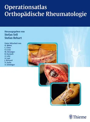 Produktbild von Operationsatlas Orthopädische Rheumatologie