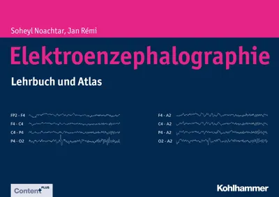 Image de Elektroenzephalographie