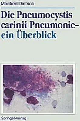 Obrázek produktu pro Die Pneumocystis carinii Pneumonie- ein Überblick