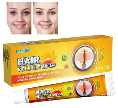 Produktbild von Pflegende Haarwurzel-Creme für Irritationen und zur Hydratation