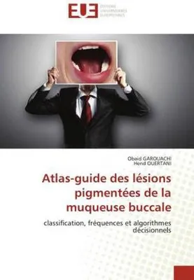 Produktbild von Atlas-guide des lésions pigmentées de la muqueuse buccale