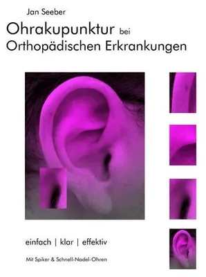 Obrázek produktu pro Ohrakupunktur bei Orthopädischen Erkrankungen