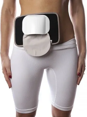 Produktbild von Stomaschutz, Stoma Protector Comfishield-Set, Farbe Sand, 60mm Öffnung