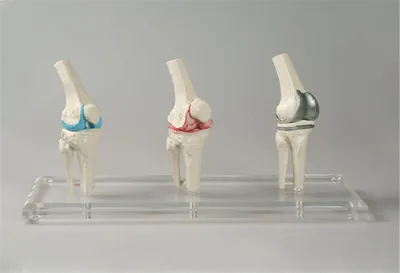 Immagine prodotto di Modello di protesi di ginocchio Erler-Zimmer