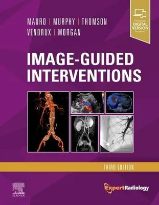 Obrázek produktu pro Image-Guided Interventions