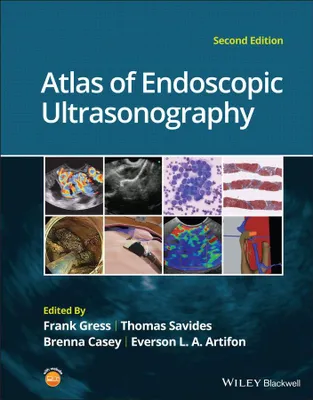 Produktbild von Atlas of Endoscopic Ultrasonography