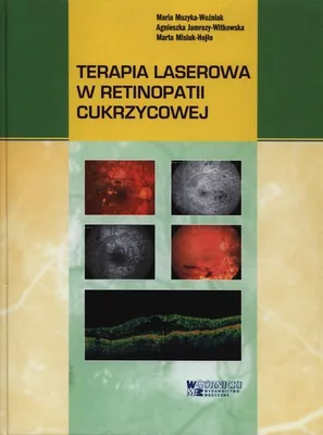 Immagine prodotto di Laserterapia nella retinopatia diabetica