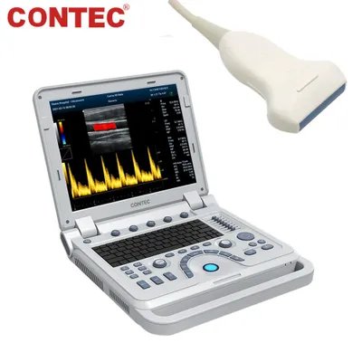 Produktbild von Tragbares Ultraschallgerät mit Linearsonde Farbdoppler B-Ultraschall 15-Zoll-Laptop