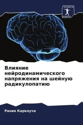 Produktbild von Vliqnie nejrodinamicheskogo naprqzheniq na shejnuü radikulopatiü