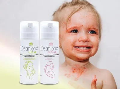 Obrázek produktu pro Dermione® - BALÍČEK PÉČE O DĚTSKOU POKOŽKU PŘI EKZÉMOVÝCH PROJEVECH - XXL
