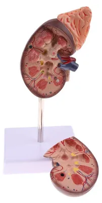 Produktbild von Solidchoice – Anatomisches Nierenmodell mit 24 Markierungen für den Bildungsbereich