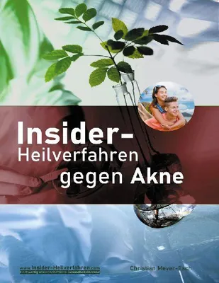Produktbild von Insider-Heilverfahren gegen Akne