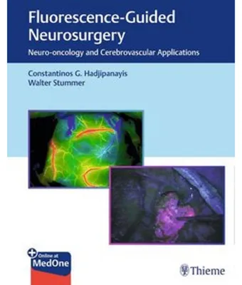 Obrázok produktu pre Fluorescence-Guided Neurosurgery