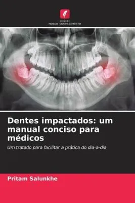 Produktbild von Dentes impactados: um manual conciso para médicos