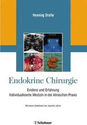 Produktbild von Endokrine Chirurgie