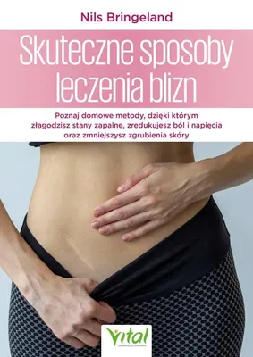 Zdjęcie produktu dla Skuteczne sposoby leczenia. Blizny