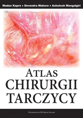 Productafbeelding van Atlas chirurgii tarczycy