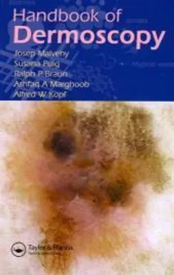 Image de Handbook of Dermoscopy