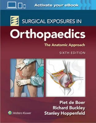 Produktbild von Surgical Exposures in Orthopaedics: The Anatomic Approach