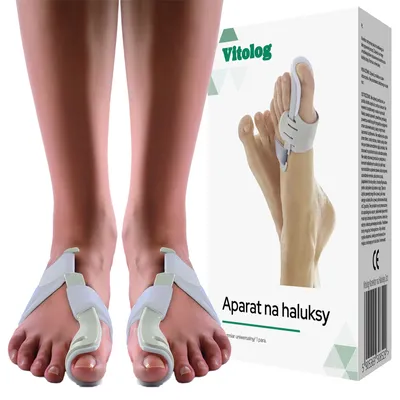Obrázek produktu pro Přístroj na Halluxy Separátor Páska Korektor Halluxu Noční Dlaha