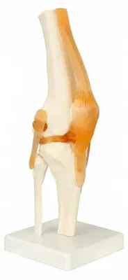 Kniegelenkmodell, lebensgroß, 30,5 cm, Anatomie-Skelett