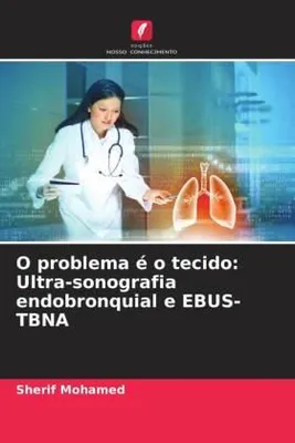 Produktbild von O problema é o tecido: Ultra-sonografia endobronquial e EBUS-TBNA