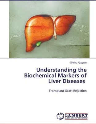 Produktbild von Understanding the Biochemical Markers of Liver Diseases