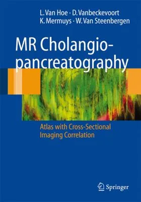 Produktbild von MR Cholangiopancreatography