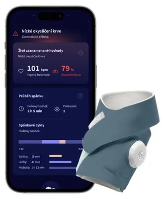 Zdjęcie produktu dla Owlet Dream Sock Pulsoksymetr monitor parametrów niemowlaka niebieski
