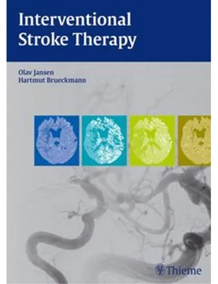Obrázek produktu pro Interventional Stroke Therapy