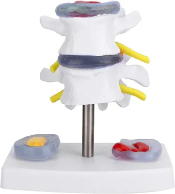 Produktbild von Solidchoice – Menschliches Lendenwirbelsäulenmodell – Skelettmodell – Abnehmbare Basis – Hervorragende Demonstration – Anatomisches Modell – Geeignet für den Unterricht – …