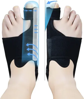 Produktbild von Hallux Valgus Korrektur Mit 2 Winkeleisen Hallux Valgus Schiene Rutschfester Gurt Ballenzehen Zehenspreizer Zehenschutz 1 Paar
