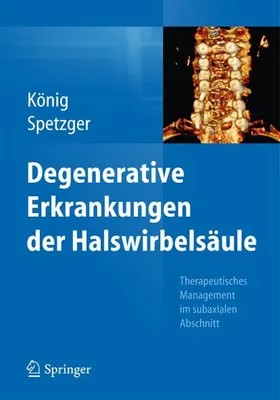 Image de Degenerative Erkrankungen der Halswirbelsäule