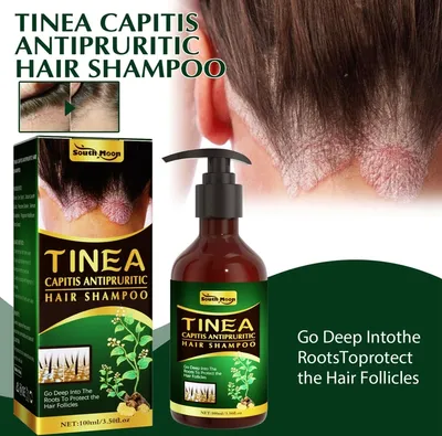 Produktbild von 100ml Shampoo Erfrischend und reparierend Kopfhaut reinigend und Anti-Schuppen-Haar-Kontrollöl Kontrolliert Juckreiz