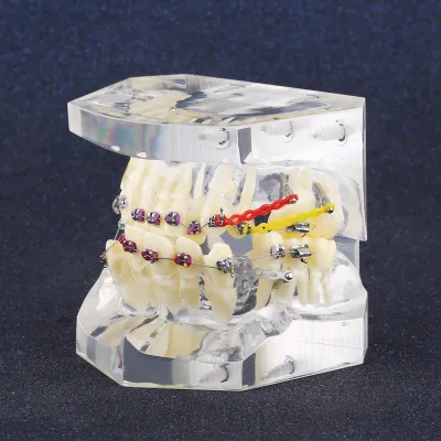 Image de Dental Orthodontic Treatment Malocclusion Study Teeth Model With Wire Chain