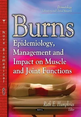 Zdjęcie produktu dla Burns