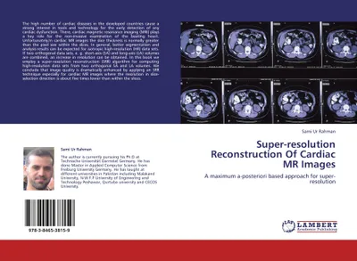 Produktbild von Super-resolution Reconstruction Of Cardiac MR Images