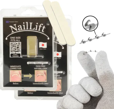 Produktbild von 2x NailLift Nagelkorrektur Korrekturspange Für Eingewachsene Zehennägel | Brandneue Innovation | Von Mediziner Entwickelt | Sofortige Wirkung | Passend für alle Nagelgrößen | Natürliche Passform