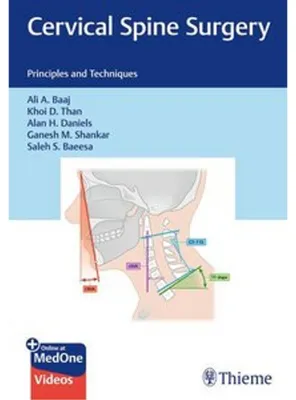 Obrázek produktu pro Cervical Spine Surgery