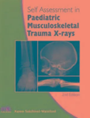 Produktbild von Self-Assessment in Paediatric Musculoskeletal Trauma X-Rays