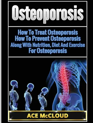Produktbild von Osteoporosis