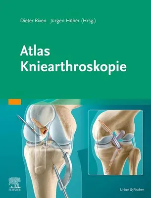 Produktbild von Atlas Kniearthroskopie