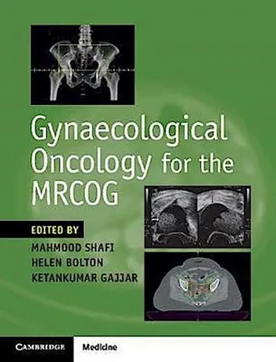 Produktbild von Gynaecological Oncology for the MRCOG