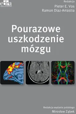 Produktbild von Pourazowe uszkodzenie mozgu